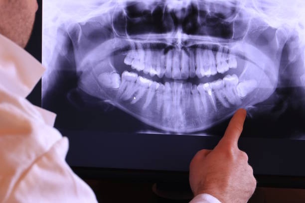 Best Emergency Tooth Extraction  in Waverly, VA